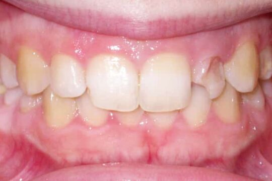 corone-integrali-03-prima