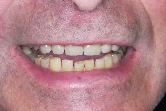 riabilitazioni-complete-01-dopo