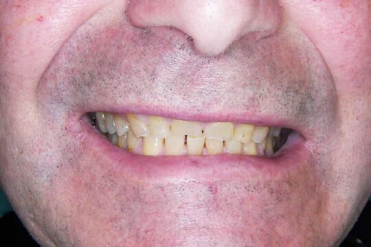 riabilitazioni-complete-01-prima