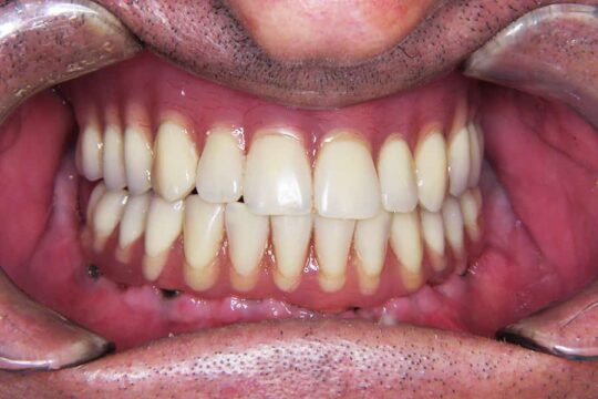 riabilitazioni-complete-02-dopo