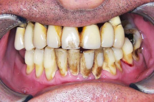 riabilitazioni-complete-02-prima