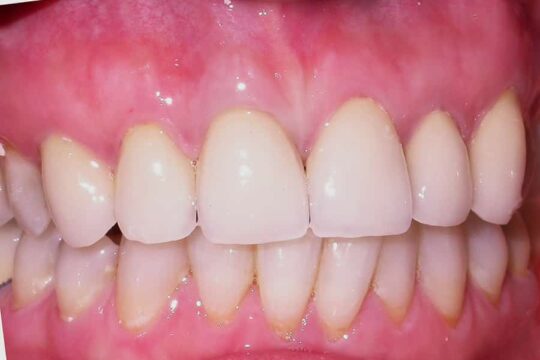 riabilitazioni-complete-04-dopo