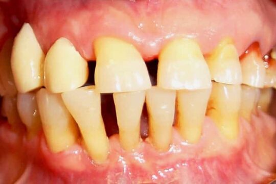 riabilitazioni-complete-05-prima