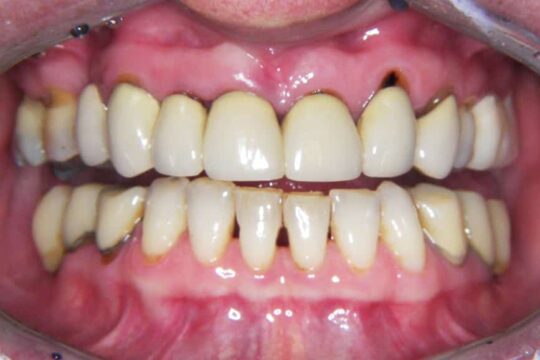 riabilitazioni-complete-06-prima