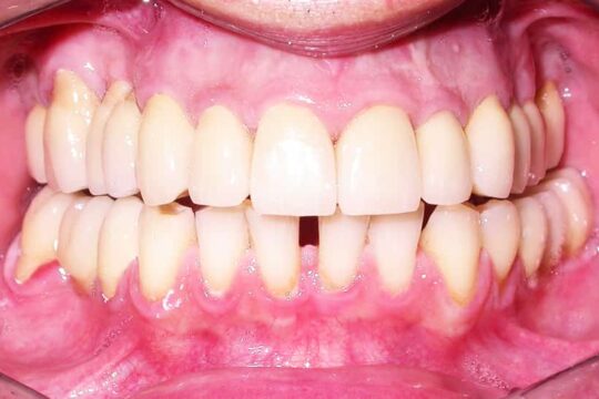 riabilitazioni-complete-07-dopo