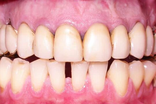 riabilitazioni-complete-07-prima