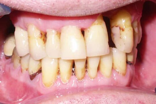 riabilitazioni-complete-08-prima