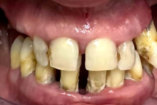 riabilitazioni-complete-09-prima